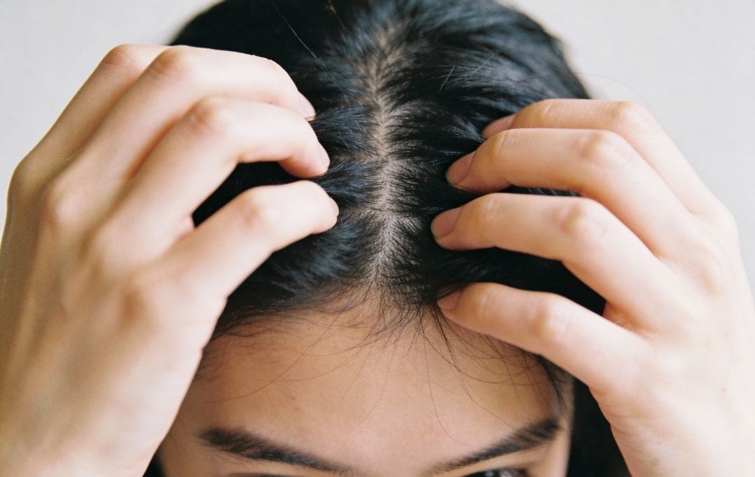 Démangeaison cuir chevelu femme
